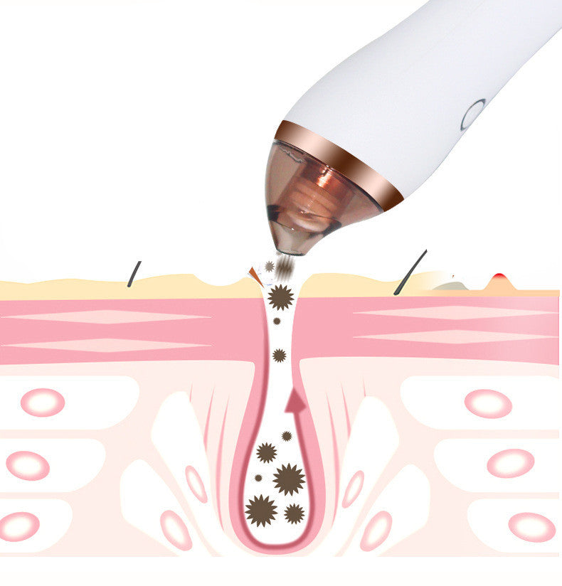 PureSkin Pro