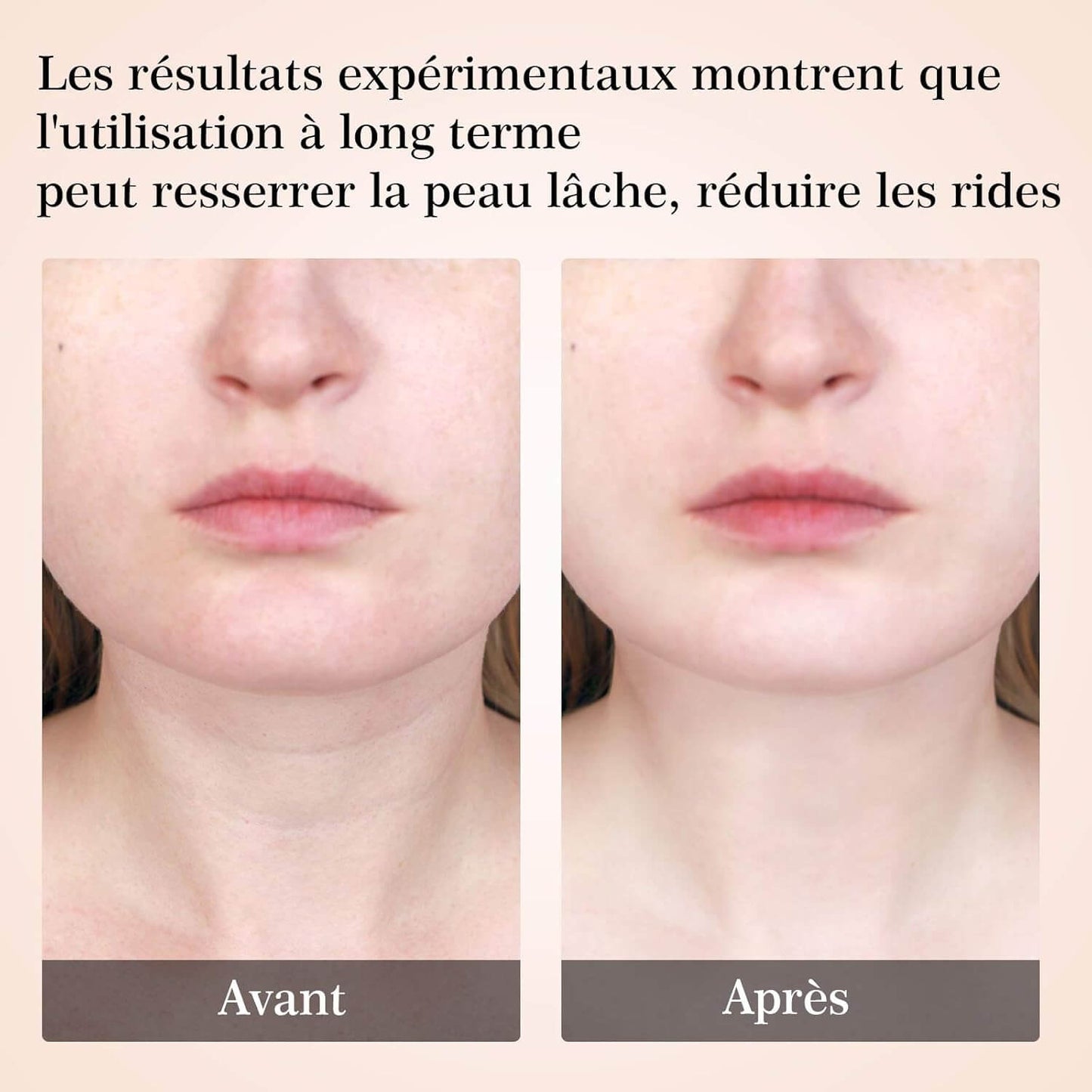 Beauty Luxe Pro : L'Appareil Innovant pour une Peau Lisse et Éclatante