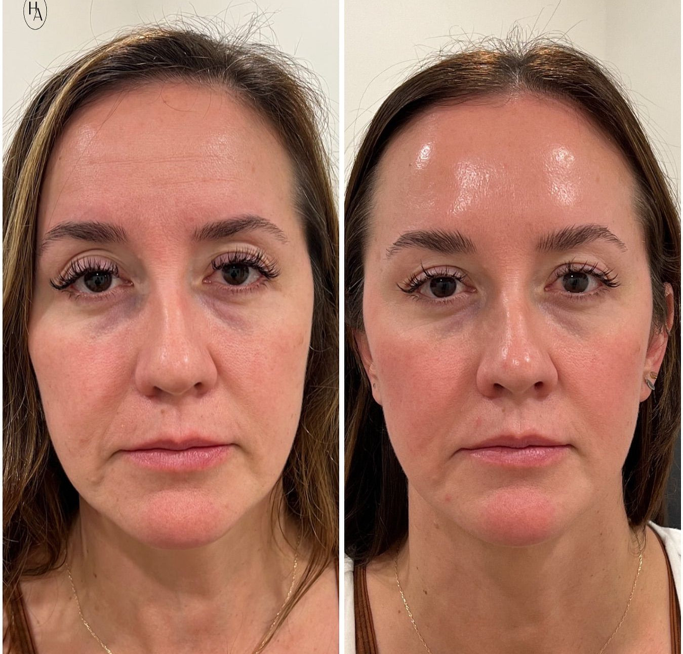 Crème Rétinol Halawah – Soin Anti-Âge Effet Immédiat