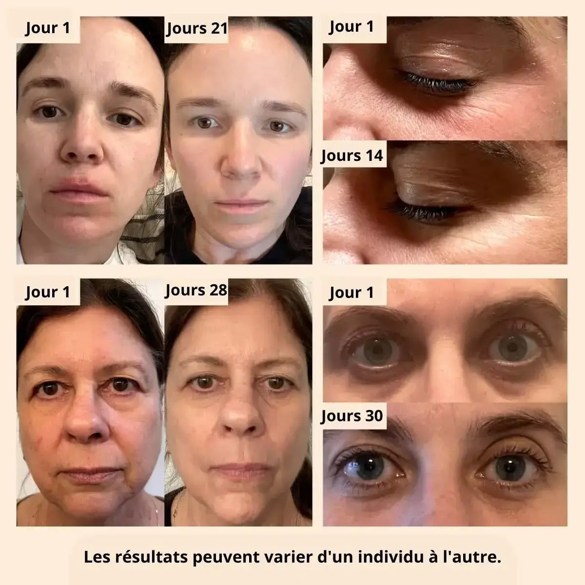 Women lift™anti cernes avec sérum anti cernes offert