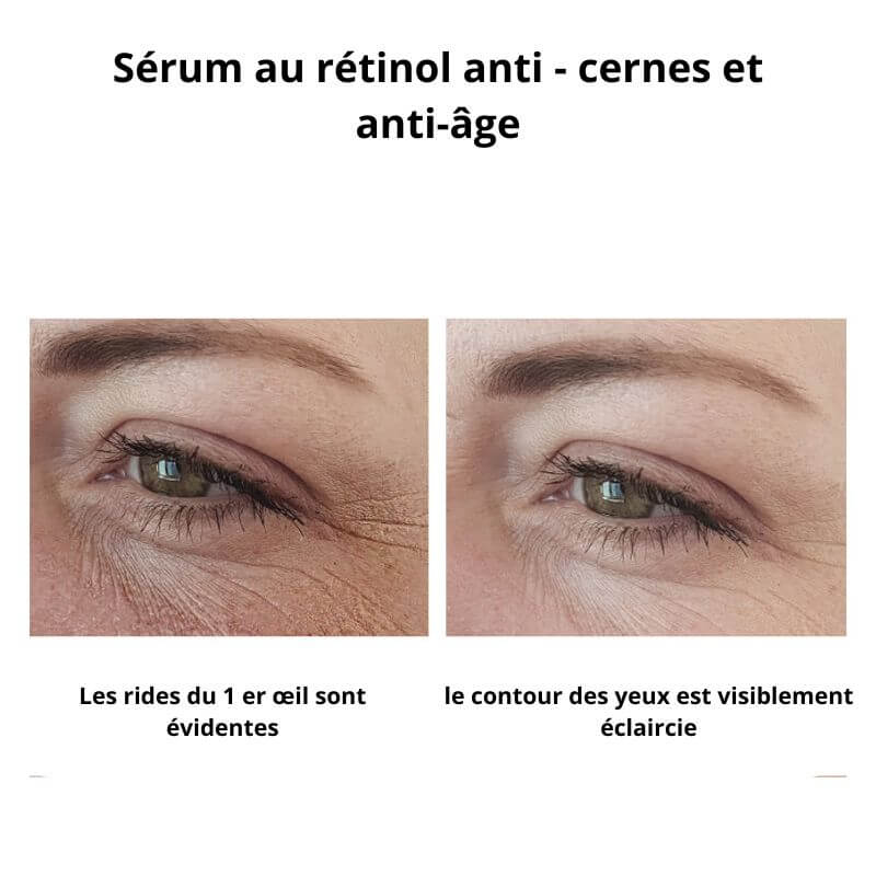 Women lift™anti cernes avec sérum anti cernes offert
