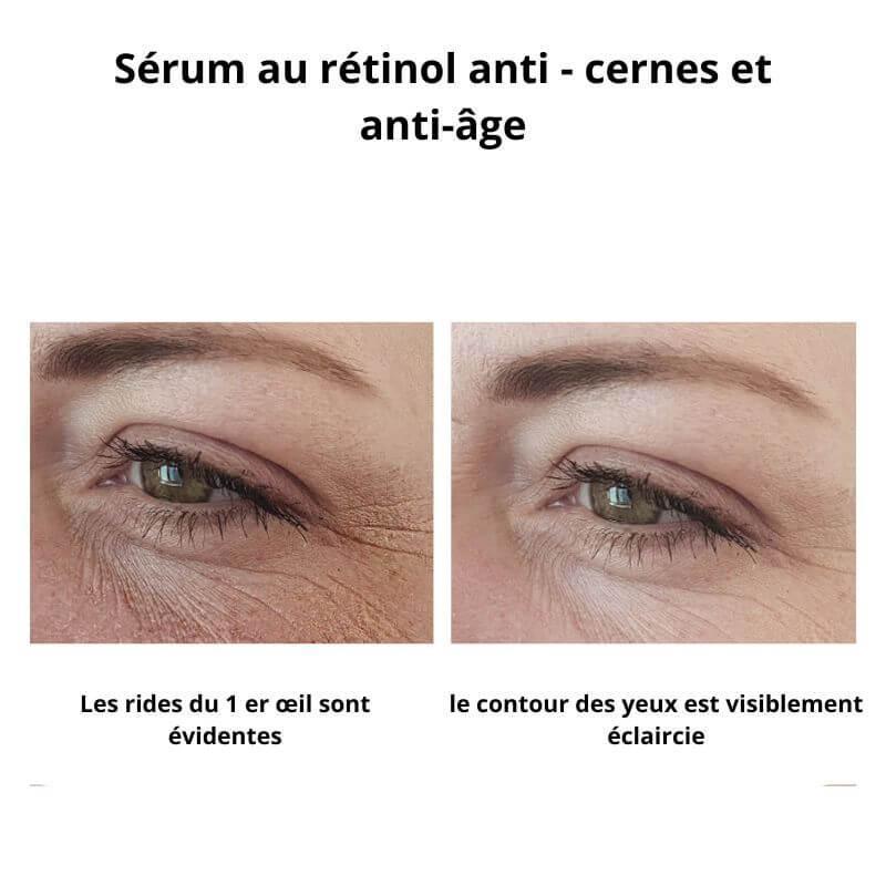 Women lift™anti cernes avec sérum anti cernes offert