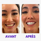 Smile kit™V34 Blanchiment Instantané Sans Peroxyde