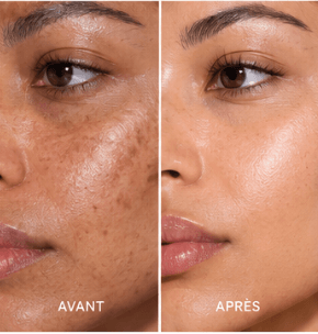 HALAWAH Glow Pads - Taches et imperfections
