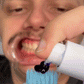 Smile kit™V34 Blanchiment Instantané Sans Peroxyde