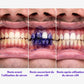 Smile kit™V34 Blanchiment Instantané Sans Peroxyde