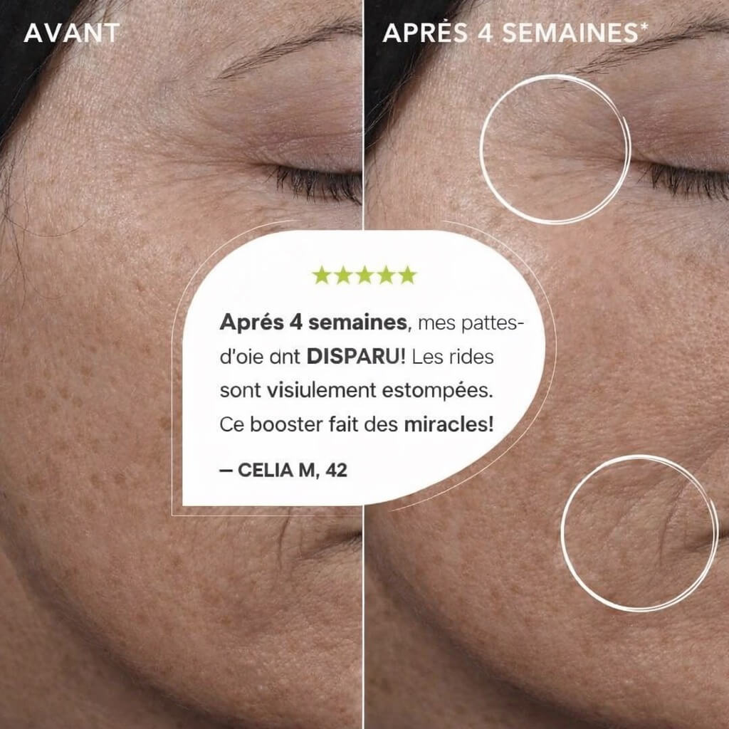 Retinal Shot™ – Rides d’Expression Lissées