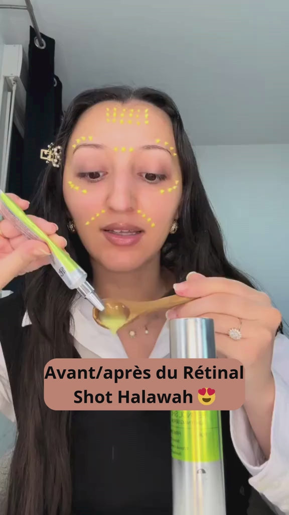 Vidéo