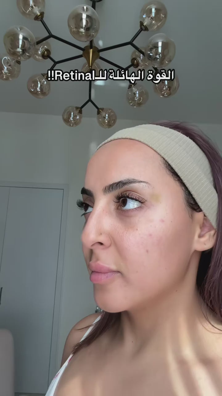 Vidéo