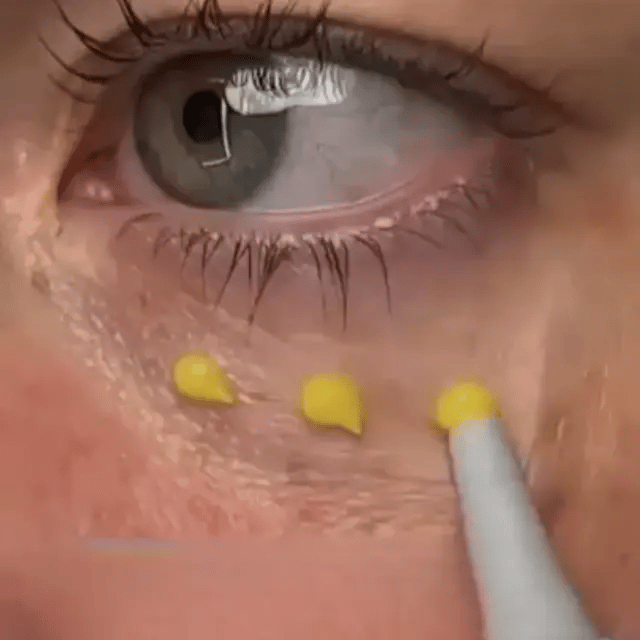HALAWAH™ Coffret Retinal Shot – Duo ciblé rides d’expression